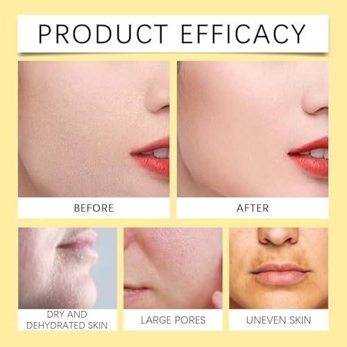 Nalacal Gold Collagen Overnight Sleeping Mask 120g - Hydrating Firming Peel-Off for Acne-Prone Skin