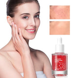 10% Niacinamide + 4% Tranexamic Acid Serum – Hyaluronic Acid & Vitamin B12 – 30ml