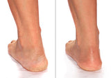 Advanced Clinicals Heel Cream - Dry, Cracked Heel Relief (8 oz)