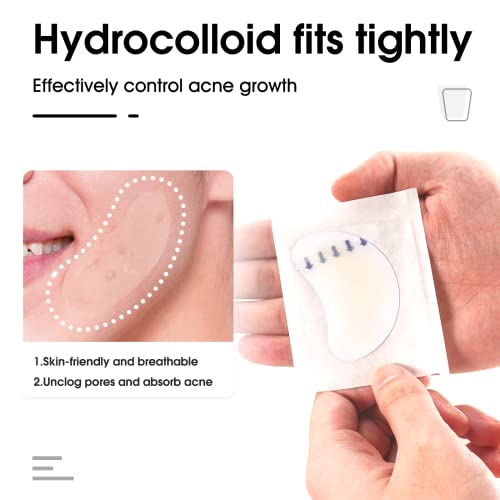 Hydrocolloid Acne Patch (20 Patches) - Large Spot Control Cover for Body, Cheek, Forehead, and Chin