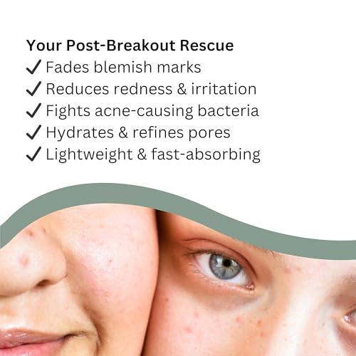 Nature's Greatest Secret Nova Balance Anti-Blemish Post-Breakout Serum 30ml