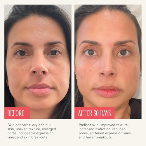 Liposomal NAD+ Shots with Nicotinamide Riboside & Resveratrol - 10x 50ml