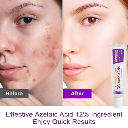 Azelaic Acid Serum Booster 12% with Hyaluronic Acid & Niacinamide - Balances Sebum, Smooths Skin & Cleanses Pores - 1pcs