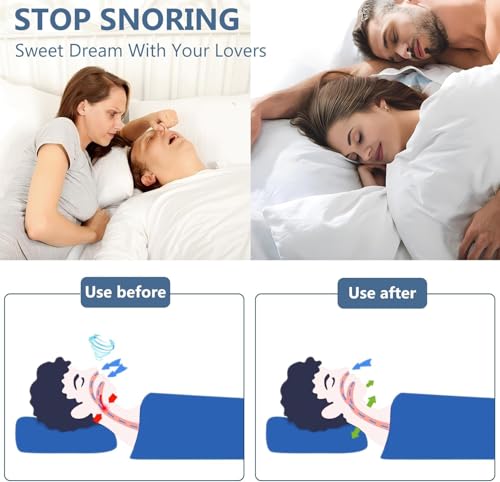 YelaJoy Silicone Magnetic Anti-Snoring Nasal Clip Set (8 Pcs)