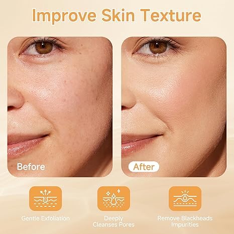 Exfoliant Rice Ampoule - Pore Minimizer & Blackhead Remover with Niacinamide, PHA & Salicylic Acid | Brightening Serum for Oily Skin