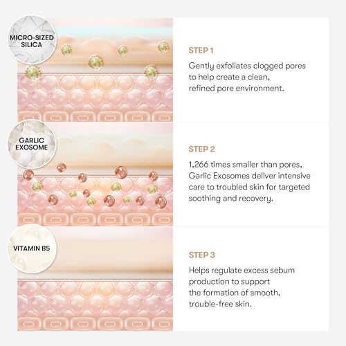 VT COSMETICS Garlic AC Reedle Spot Patches: Powerful Acne Treatment (48 Patches)