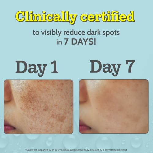 Chemist At Play 10% Vitamin C Face Serum - Brightening & Glow Boosting Serum