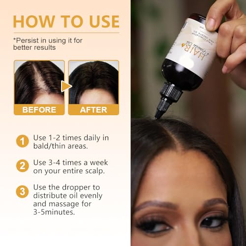 Hair Growth Oil - Natural Scalp Stimulator with Rosemary, Mint & Omega 3,6,9 - 1.7 fl oz/50 ML