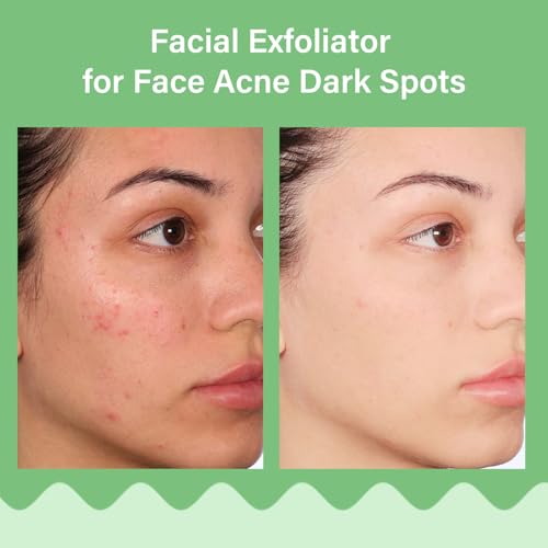 Aloe Vera Peeling Gel - Sparkling Facial Scrub for Deep Cleansing & Gentle Exfoliation | All Skin Types