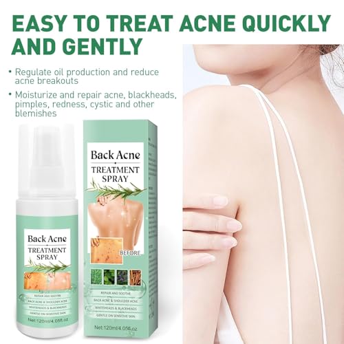 Azonee Back Acne Treatment Spray - Tea Tree, Salicylic Acid, 2% Aloe, 4 oz