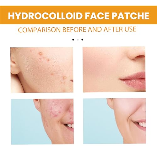 Hydrocolloid Face Mask - Large Pimple Patches for Zit Breakouts, Vegan & Cruelty-Free