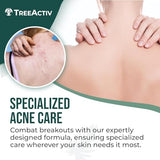 Body Acne Spray 2% Salicylic Acid with Aloe, Tea Tree, 4 oz, Back Acne Solution