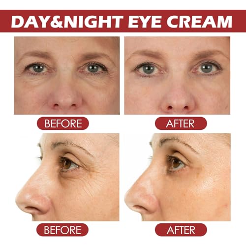 Retinol Day & Night Eye Cream Stick 4g Dual-Action Anti-Aging For Dark Circles & Puffiness