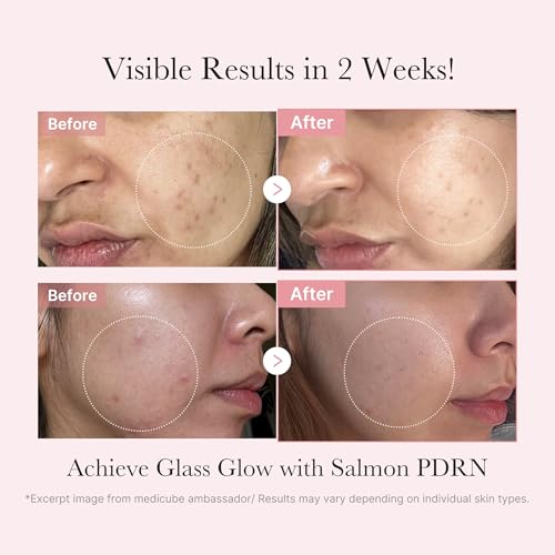 Medicube PDRN Trial Kit - Lotion, Beauty, Cream & Face Mask Pack for Glossy Skin