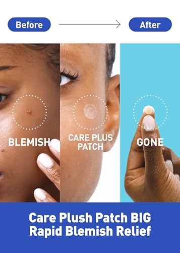 OLIVE YOUNG Care Plus Spot Patch - Hydrocolloid Acne Pimple Patch (510 Count, Pack of 5)