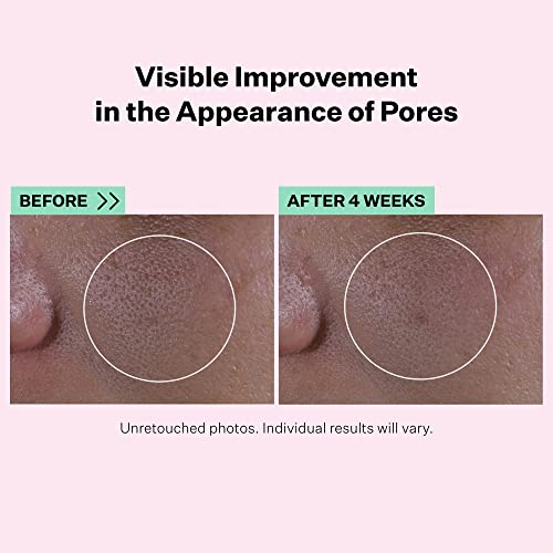 StriVectin Multi-Action Super Shrink Pore Minimizing Serum - Minimize Pores & Brighten Skin