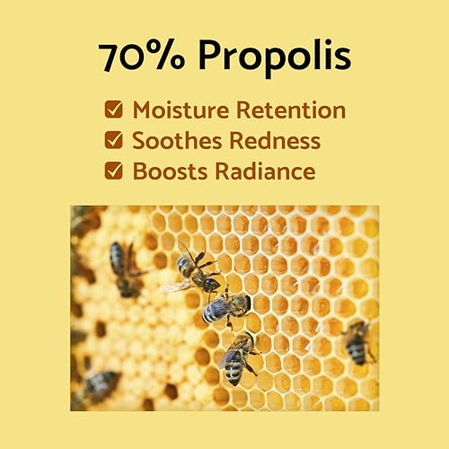 IUNIK Propolis 70% + Vitamin 17% Synergy Serum - Centella Asiatica for Dry, Sensitive & Acne-Prone Skin | Korean Skincare