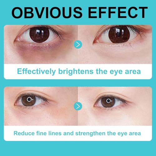 Caffeine Brightening Eye Cream - Caffeine Anti-Aging, Dark Circle Eye Bags, Niacinamide, Retinol, Squalane, Peptides, K-beauty