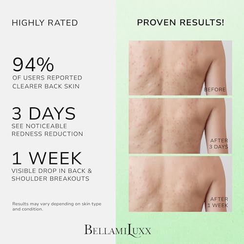 BellamiLuxx Back & Body Acne Treatment Spray with Tea Tree Oil for Clear, Soothe & Moisturize - Effective for Men, Women & Teens