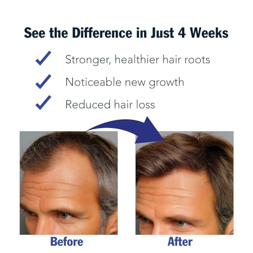 Hair Growth Serum for Men - Hair Loss & Hair Growth Scalp Treatment Oil to Stop Hair Fall & Receding Hairline - Scalp Strengthening Oil for Thicker and Fuller Hair Enhancer, 30ml