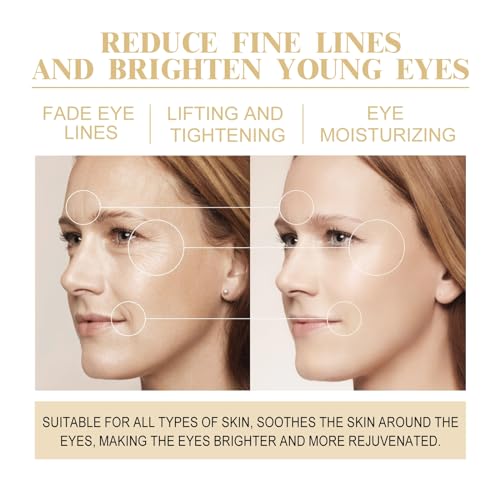 Collagen Eye Cream - Hydrates, Nourishes & Tightens Under Eye, Reduces Lines, 30ml