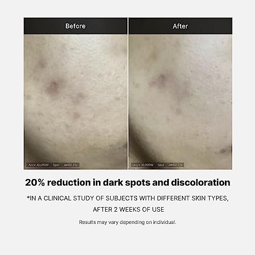 Medicube Deep Vita C Serum 2.0 - 14.5% Pure Vitamin C for Hyperpigmentation & Dark Spots - Korean Skincare (3 x 10g)