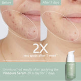 Caudalie Vinopure Natural Salicylic Acid Pore Minimizing Serum (30ml)