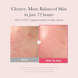 Niacinamide + Tranexamic Acid Serum 30ml – Brightening & Even Skin Tone Serum