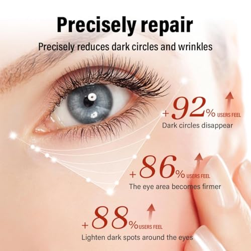 Retinol Eye Cream for Dark Circles and Puffiness - Wrinkle Cream and Brightening Solution, 30g