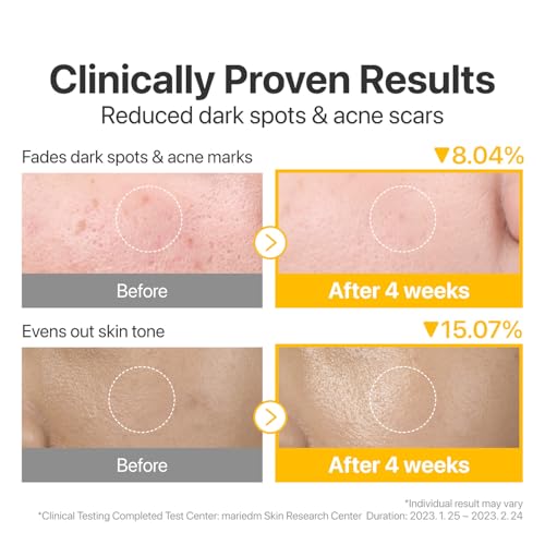 numbuzin No.5 Vitamin-Niacinamide Concentrated Pad – Exfoliating & Brightening Treatment Pads for Clear, Even Skin