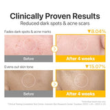 numbuzin No.5 Vitamin-Niacinamide Concentrated Pad – Exfoliating & Brightening Treatment Pads for Clear, Even Skin