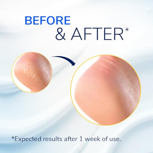Dr. Scholl's Cracked Heel Repair Balm 2.5oz - 25% Urea for Dry Cracked Feet - Heals & Moisturizes for Healthy Feet