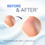 Dr. Scholl's Cracked Heel Repair Balm 2.5oz - 25% Urea for Dry Cracked Feet - Heals & Moisturizes for Healthy Feet