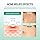 SOME BY MI 30 Days Miracle Clear Spot Patches (18 Count)