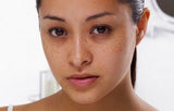 ACM Depiwhite Advanced Brightening Cream (40ml) - Even Skin Tone