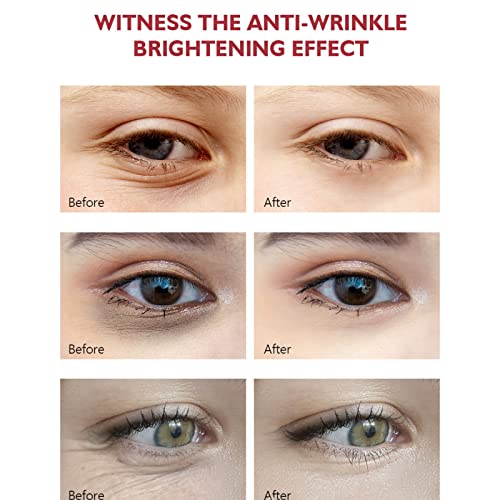 Retinol Eye Cream with Hyaluronic Acid & Vitamin E, Fast-Acting Dark Circle & Fine Line Reducer