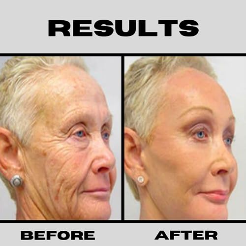 Retinol + Niacinamide B3, Vitamin C, Hyaluronic Acid Serum - Anti-Aging & Brightening Face Serum (8oz)
