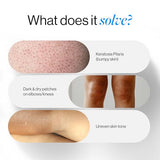 5% Lactic Acid Body Lotion - Women, Aloe Vera & Cica | Strawberry Legs Reduction, 200ml