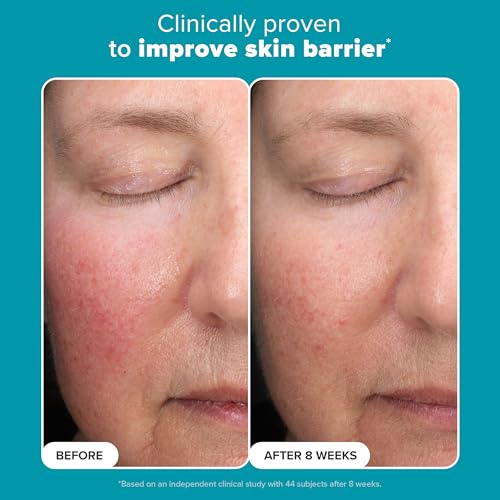 Paula’s Choice 6% Mandelic Acid + 2% Lactic Acid Exfoliant - Gentle Daily AHA for Sensitive Skin, 3 Fl. Oz