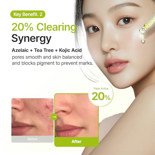 PURITO Azelaic Acid 10 Kojic Tea Tree Serum - Acne & Uneven Tone for Dermatologist-Recommended Treatment