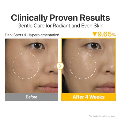 numbuzin No.5+ Glutathione & Vitamin Concentrated Serum for Dark Spots – Korean Skincare Brightening Treatment (1.01 fl.oz/30ml)