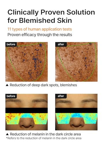 celimax Pore Minimizer Brightening Cream with Niacinamide & TXA