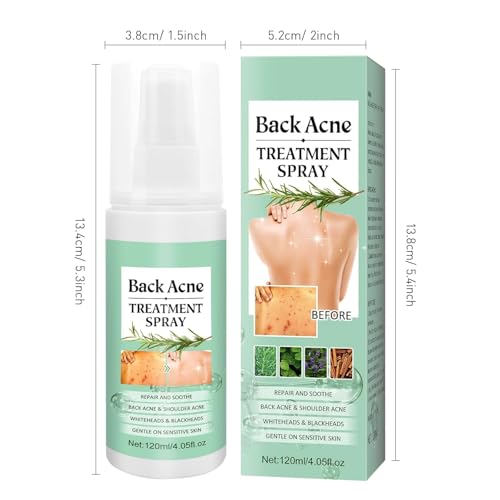 Azonee Back Acne Treatment Spray - Tea Tree, Salicylic Acid, 2% Aloe, 4 oz