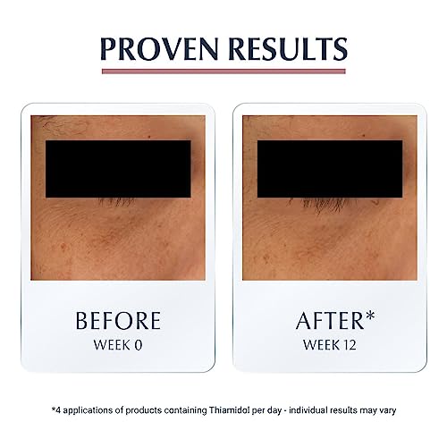 Eucerin Anti-Pigment Dark Circle Eye Care 15ml, Drives Hyperpigmentation, Refreshing