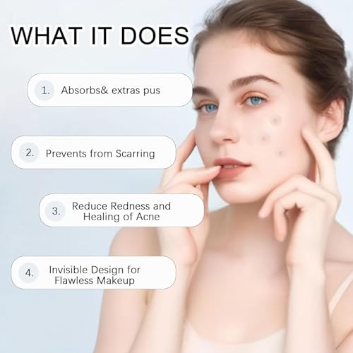 Sawanork Pimple Patches for Face - 216 Count Hydrocolloid Acne Stickers (2 Sizes)