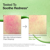 Anua Azelaic Acid 10% Hyaluronic Redness Soothing Serum - Korean Skincare for Sensitive Skin with Niacinamide & Hyaluronic Acid - 30ml