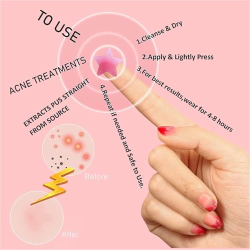 X spring Acne Patch - 126 Count Star-Shaped Hydrocolloid Patches for Face & Body