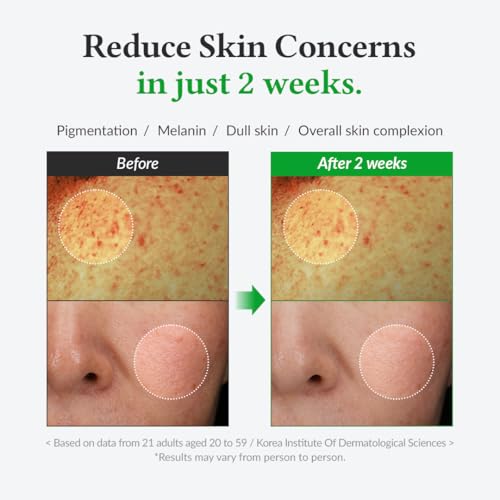 Dr.Althea Vitamin C Boosting Serum & Gentle Vitamin C Serum - Sensitive Skin Friendly, Even Skin Tone, Pigmentation Treatment (Gentle Vitamin C)