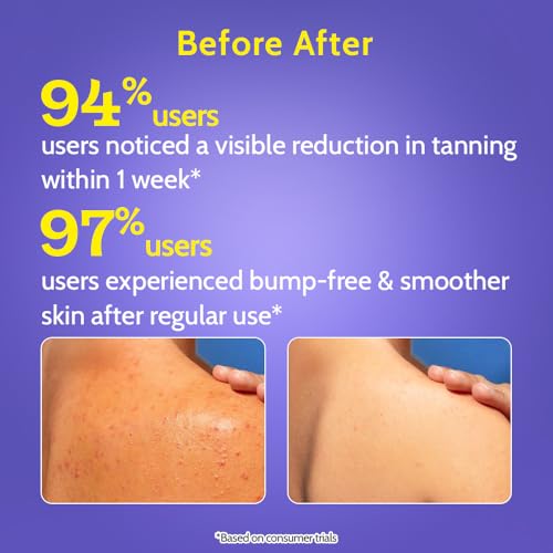 Chemist At Play 1% Salicylic Acid Exfoliating Body Wash - Paraben & SLS Free - 236ml