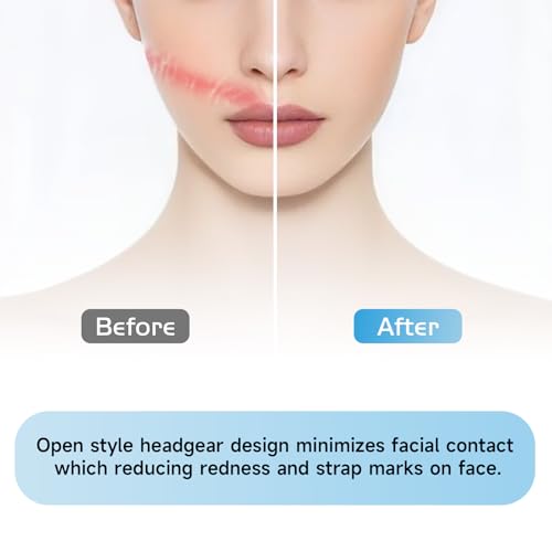 2-Pack Replacement Nuance Pro CPAP Headgear for Philips Respironics Nuance Pro Gel Mask